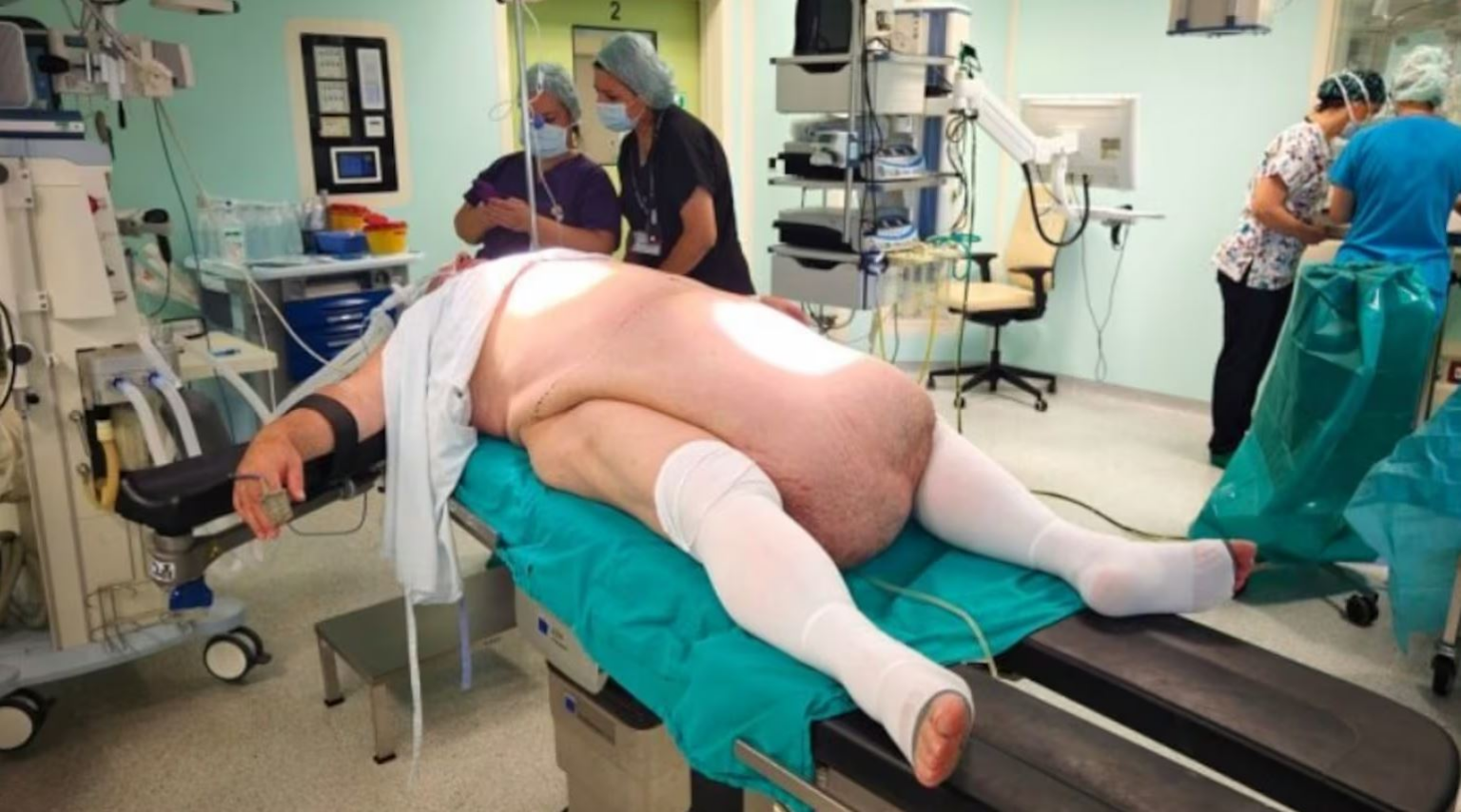 Homem intriga médicos com tumor ‘gigante’ de 35kg; entenda
